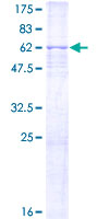 12.5% SDS-PAGE Stained with Coomassie Blue.